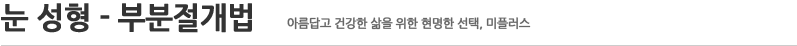 부분절개법